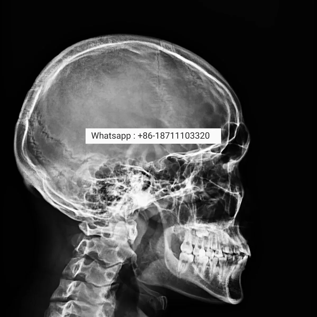 Рисунок 5 - Медицинское радиологическое оборудование
