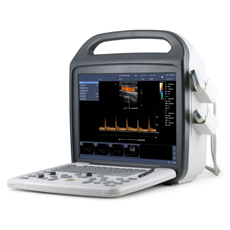 

Economical Basic 4D Mode Portable Color Doppler Ultrasound for Animals