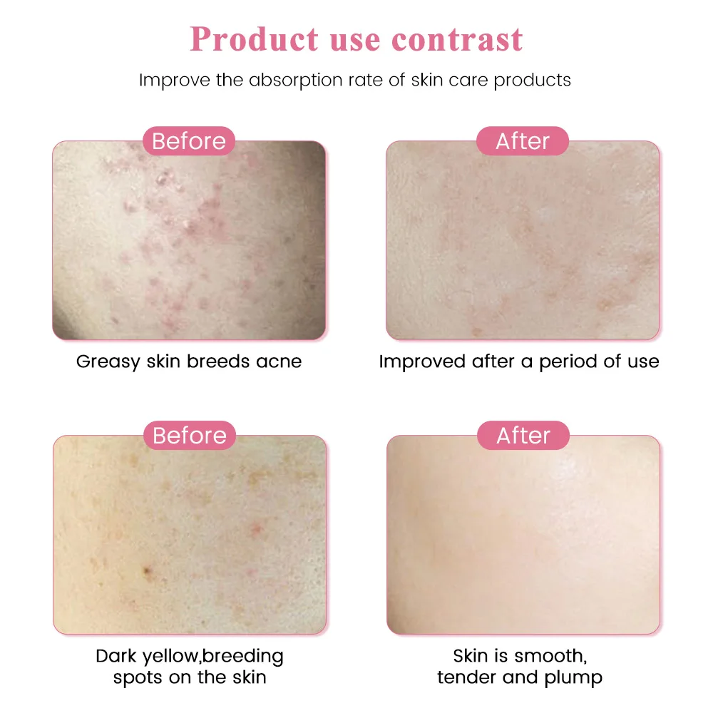 Рисунок 4 - Профессиональная Беспроводная электрическая