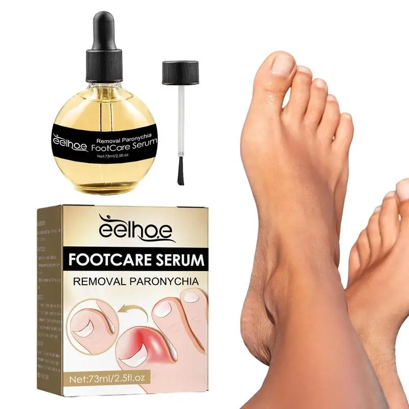 

Foot Care Products For Toenail Funguss Nail Repair & Improve Toenail Health With Anti Paronychia Serums Toenail Care Oil For Men