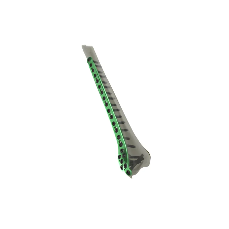 

Orthopedic Locking Plates Distal Medial Tibial Locking Fracture Plate