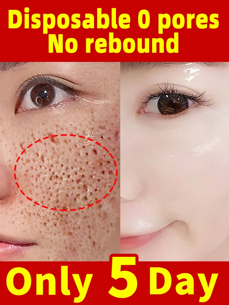 

Salicylic Acid Pore Shrink Face Serum Hyaluronic Acid Moisturizing Nourish Smooth Pores Repair Essence Firm Skin Korean Cosmetic
