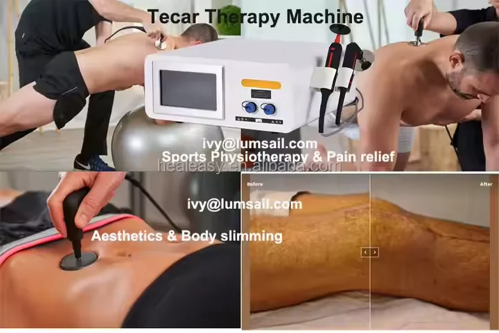 Фото Профессиональный аппарат для физиотерапии с технологией RF 448 кГц для лифтинга лица и удаления морщин по заводской цене №2