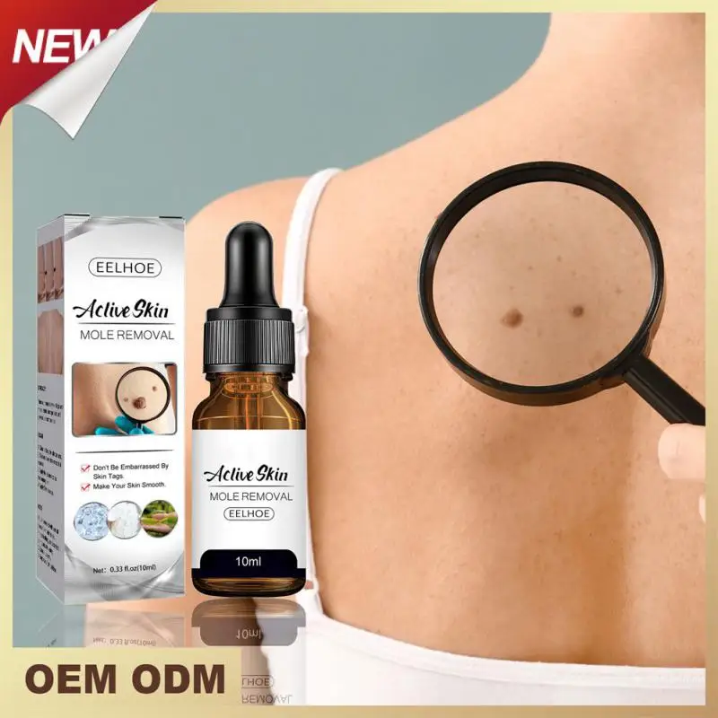 

Wart Mole Removal Painless Fast Remover Serum Wart Tag Serum Skin Removal Mole Fast Remover Skin Care