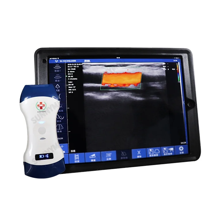 

Wireless 128 convex probes portable dual head color Doppler
