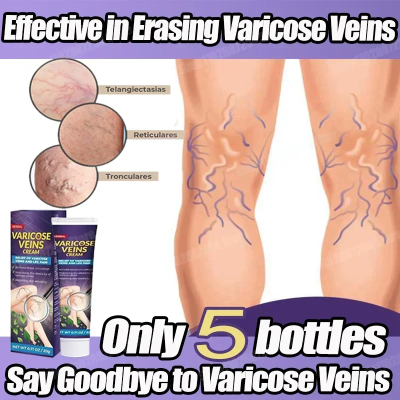 Мазь от варикозного расширения вен эффективный крем для облегчения чтобы