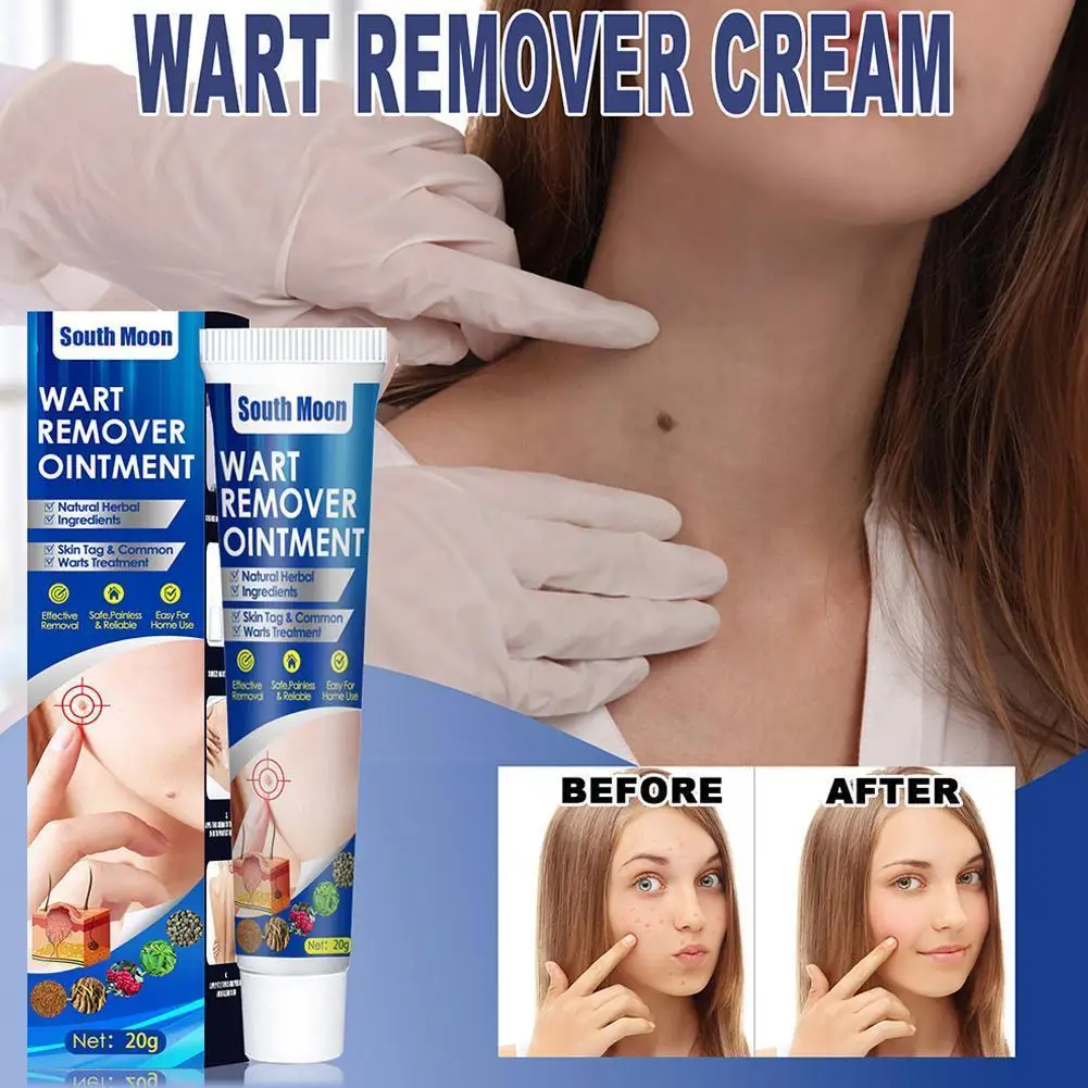 

Warts Remover Cream Skin Tag Remover Against Mole Antibacterial Ointment Treatment Wart Herbal Corn Plaster Extract W5w2