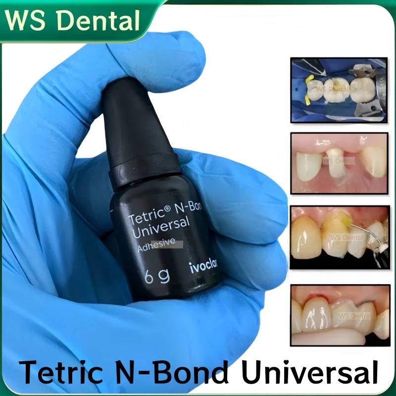 6 г 8-й стоматологический N-образный клей для тетрических бутылок большая доза