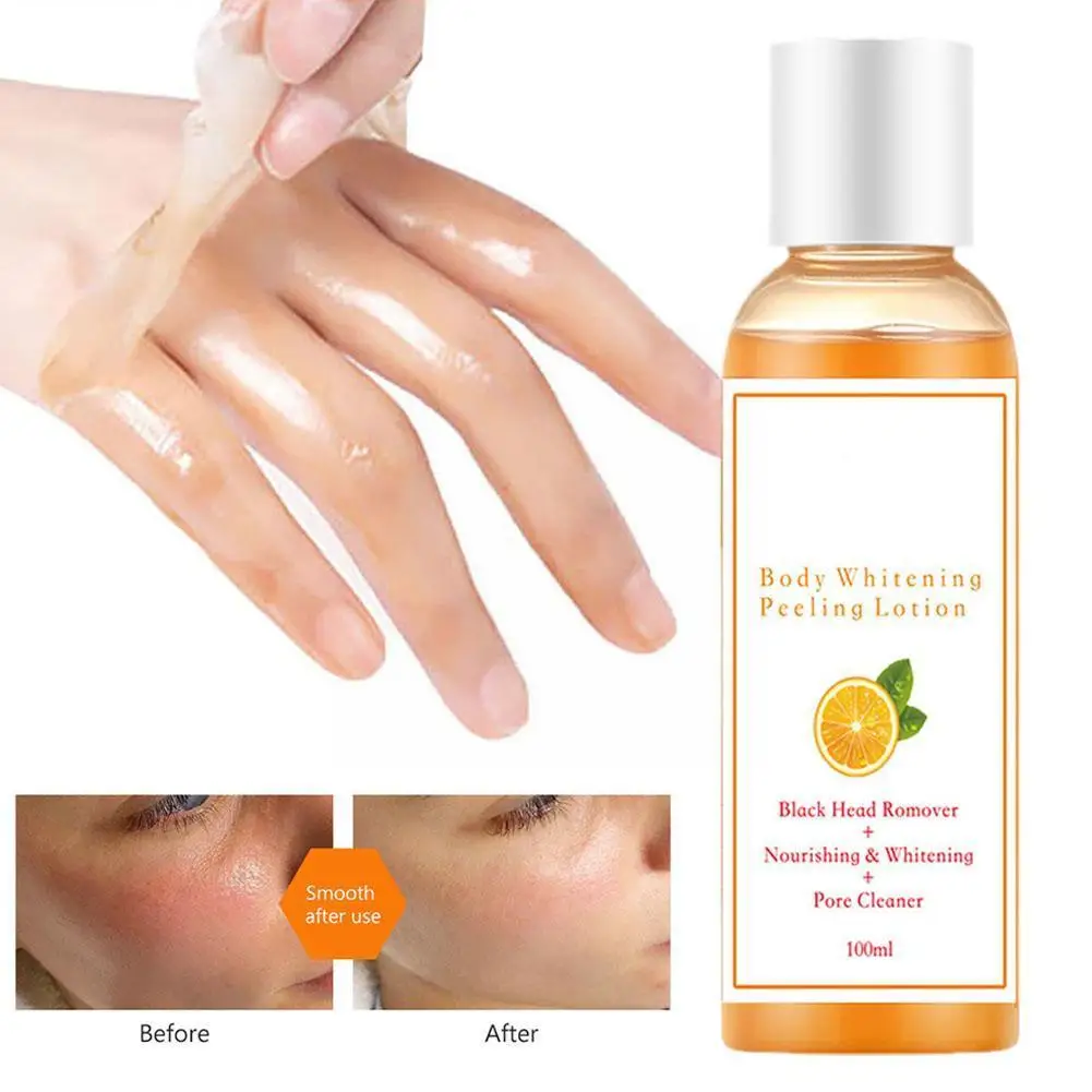 

100ml Peeling Oil Vitamin C Orange Body Face Lotion Whitening Anti Knuckles Intense Remove Skin Dark Dead Peeling G5X9