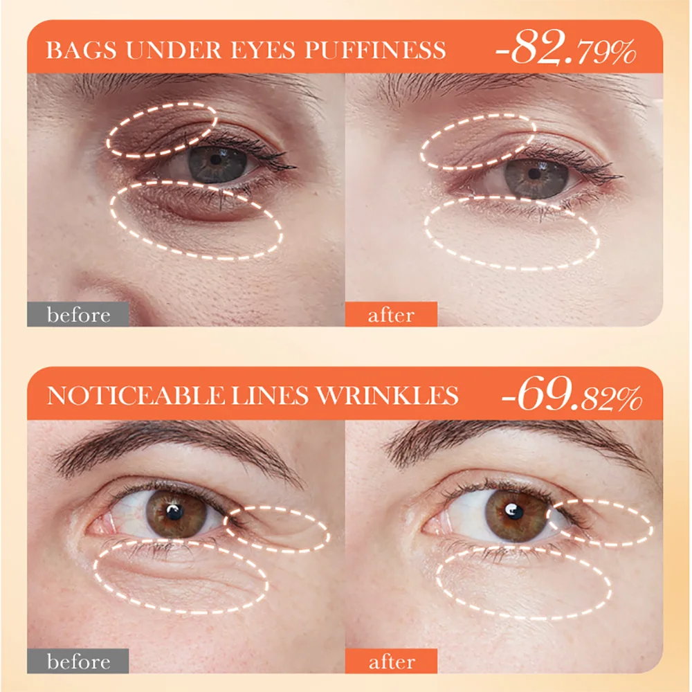 Крем с витамином С под глазами Crema Antiojeras Antiarrugas Hombre Ojeras Oscuras Eliminacion против морщин