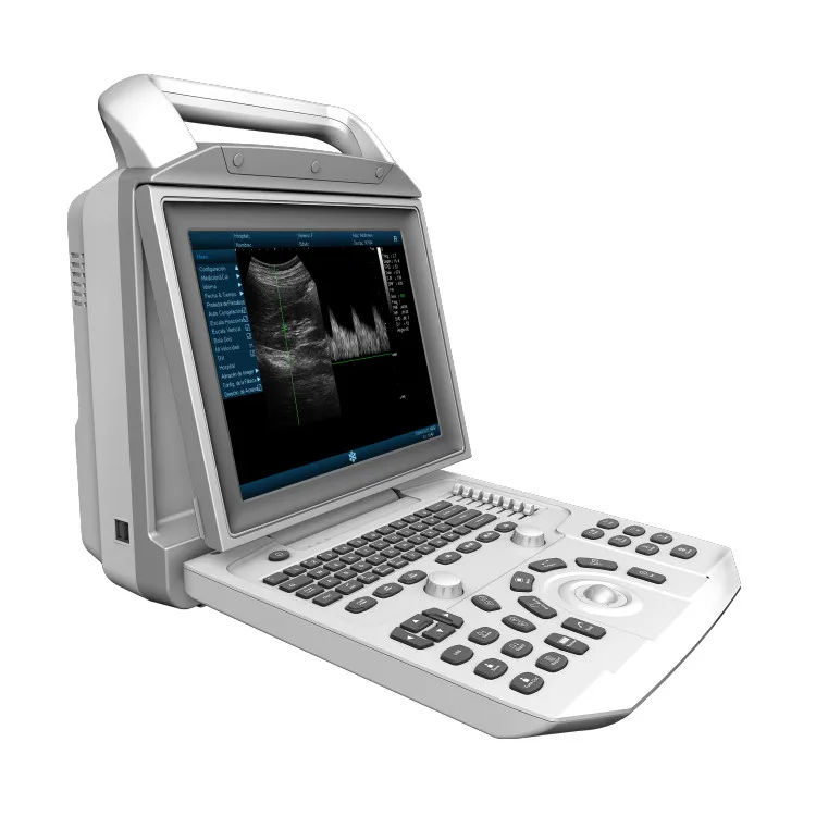 

High Quality Ultrasound System Price Digital Ultrasound Diagnostic Instruments Ultrasound Scanner