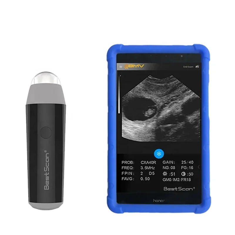 BestScan S3 беспроводное портативное ветеринарное ультразвуковое