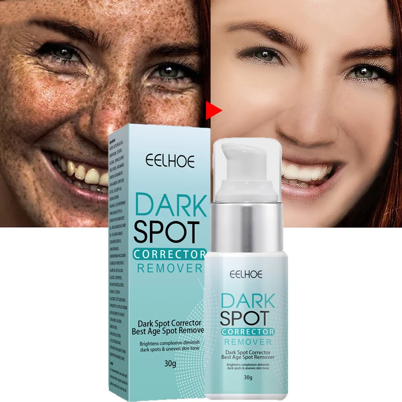 

Nicotinamide Whitening Freckle Cream Dark Spot Remover Skin Care Products Moisturizing Brighten Pigment Correction Face Beauty