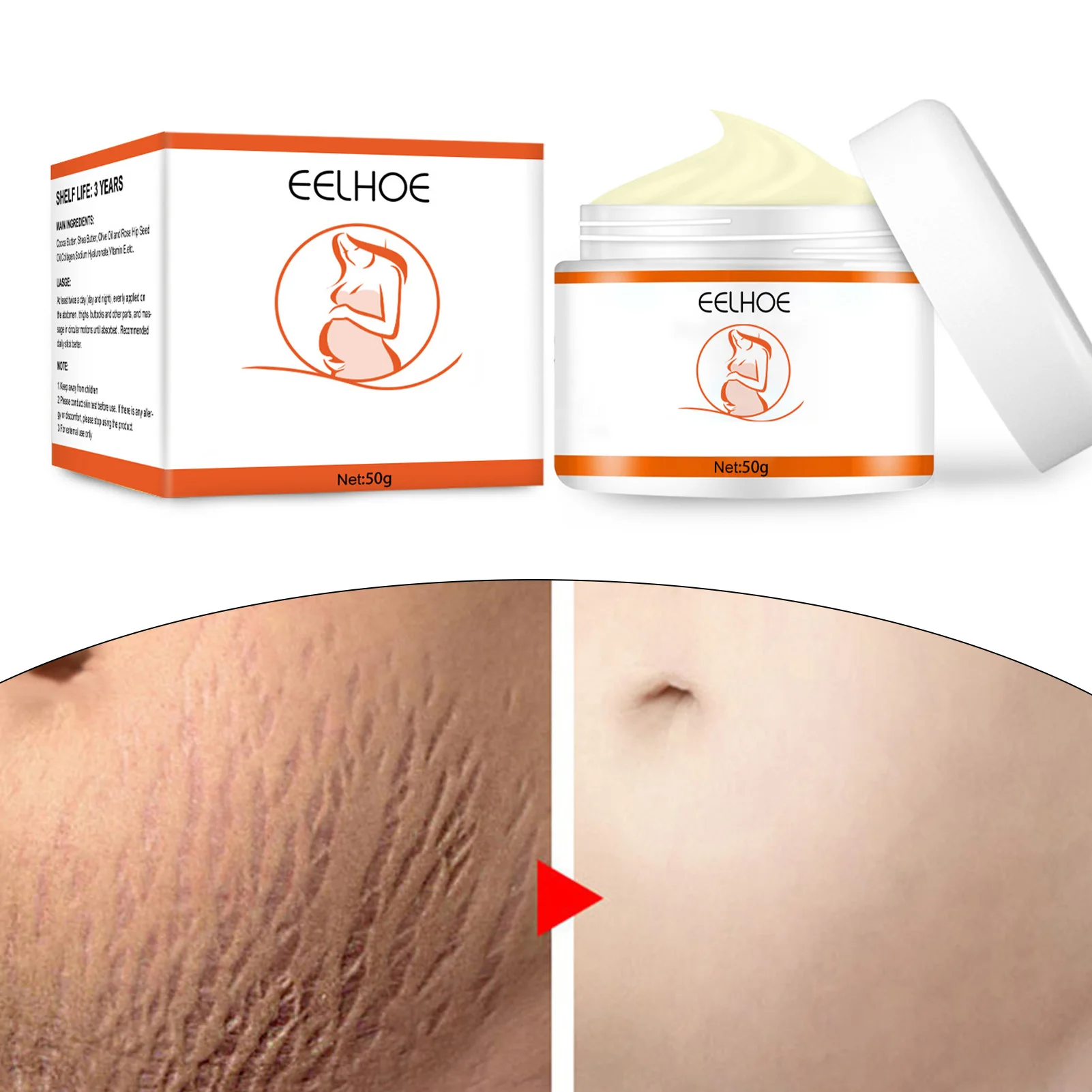 

Maternity Stretch Mark Prevention Cream Stretch Mark Remover For Pregnancy Women Skin Repair Creams All-Natural Body Daily