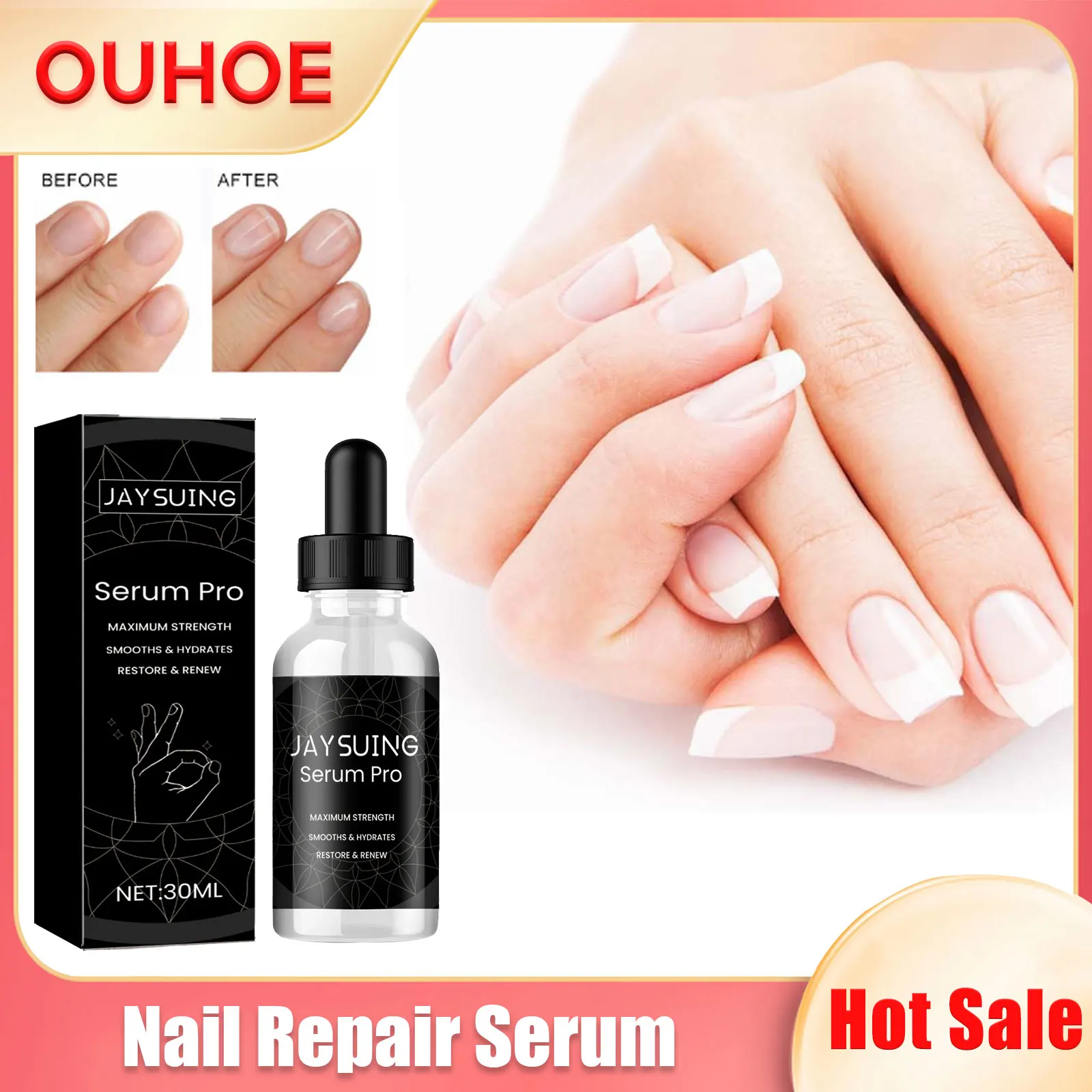 

Nail Repair Serum Discoloration Fungal Treatment Anti Infection Strengthening Cuticle Onychomycosis Paronychia Removal Essence