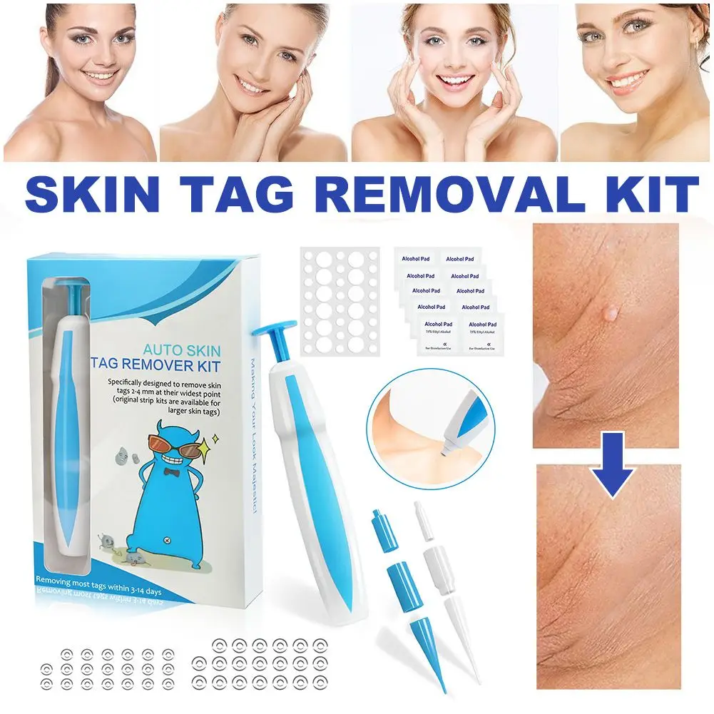 

Инструменты для безболезненного удаления бородавок на ногах, набор из 40Х резинок + 10х спиртовых накладок, набор для удаления бородавок на те...