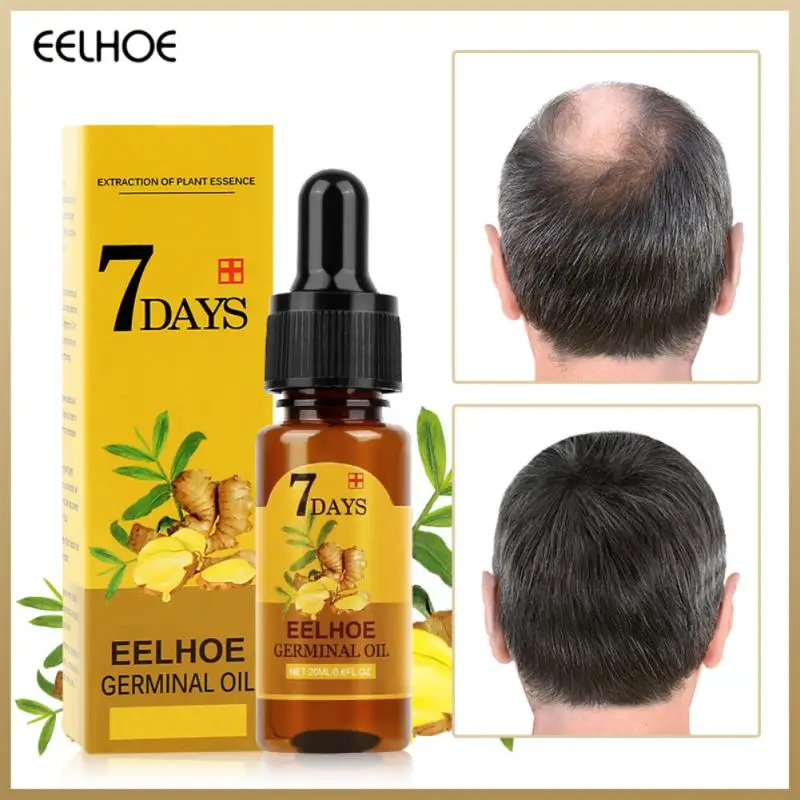

Имбирные продукты для роста волос эффективное предотвращение выпадения волос эфирное масло быстрорастущее лечение кожи головы Красота Здоровье для мужчин и женщин