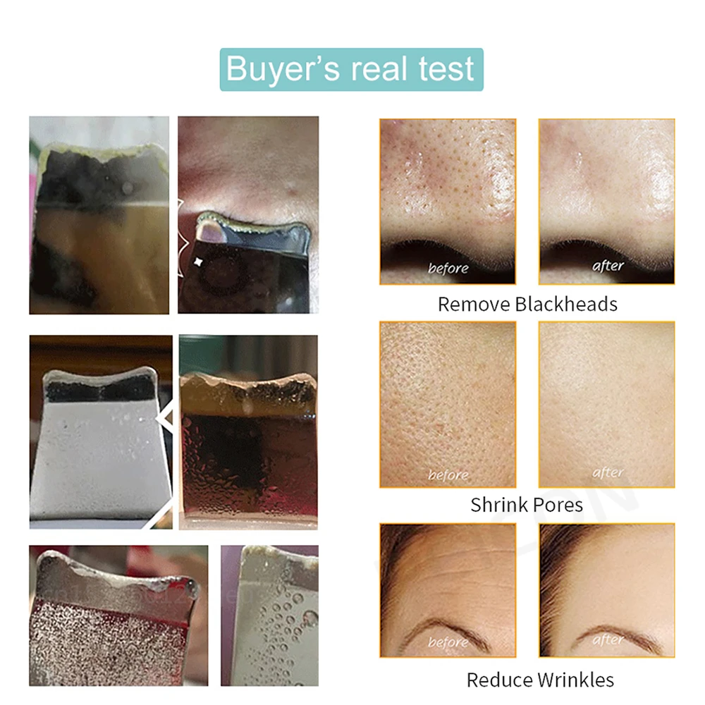 Ultradźwiękowy Peeling do skóry Peeling usuwająca zaskórniki głębokie czyszczenie twarzy ultradźwiękowy jon Ance do oczyszczania porów twarzy łopata do mycia twarzy 6 Ultradźwiękowy Peeling do skóry Peeling usuwająca zaskórniki głębokie czyszczenie twarzy ultradźwiękowy jon Ance do oczyszczania porów twarzy łopata do mycia twarzy 6