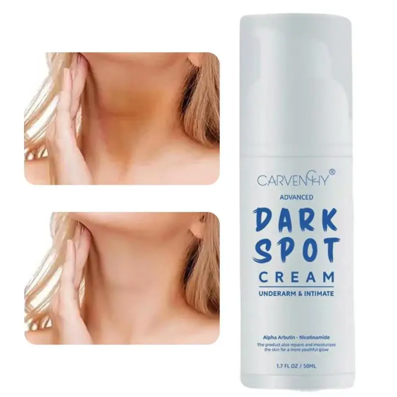 

Body Brightening Cream Pigmentation Cream For Sun Spot Skin Care Effective Moisturizing Spot Removal Skin Cream For Uneven Skin