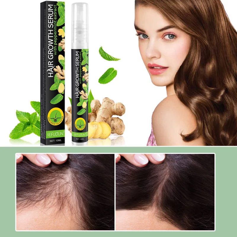 

Ginger Hair Growth Spray Fast Anti Hair Loss Treatment Products Strong Nourishing Repair Damaged Roots Hair Care Serum 10ml
