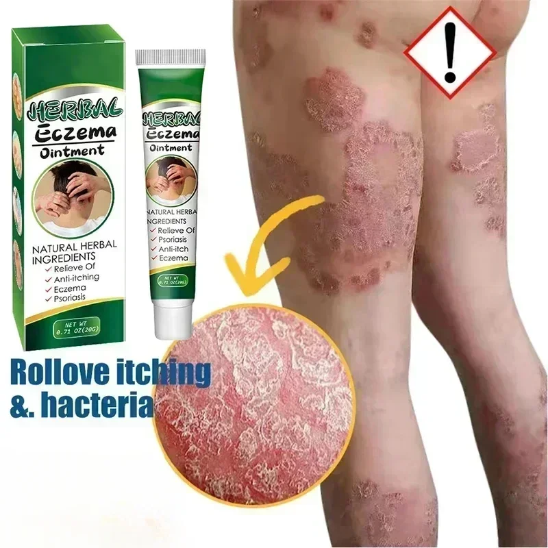 Лечение короткого псориаза мох специальная мазь для лекарств псориаз тела и