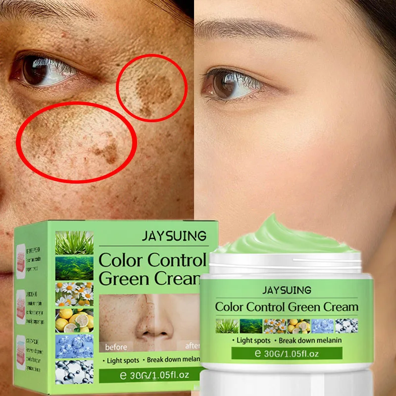 Face Whitening Cream Lighten Dark Spots Break Down Melanin Melasma Pigment Brighten Freckles Anti-Aging Wrinkle Korean Cosmetic