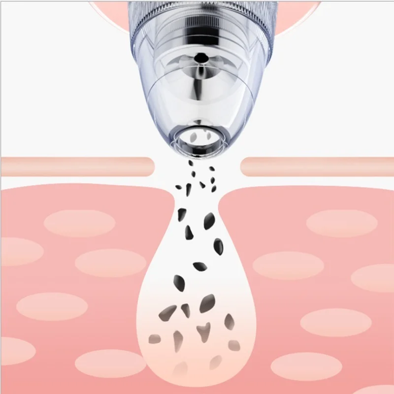 Электрический вакуумный очиститель пор для удаления черных точек на лице |