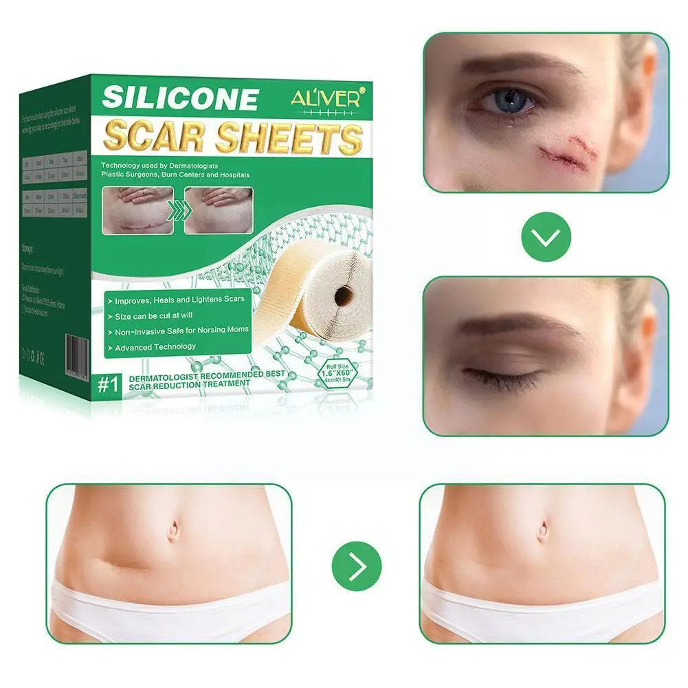 

4*150cm Surgery Scar Removal Silicone Gel Patch Treatment Therapy Sheet Burn Efficient Repair Acne Skin Scar Tools Trauma T J8n3