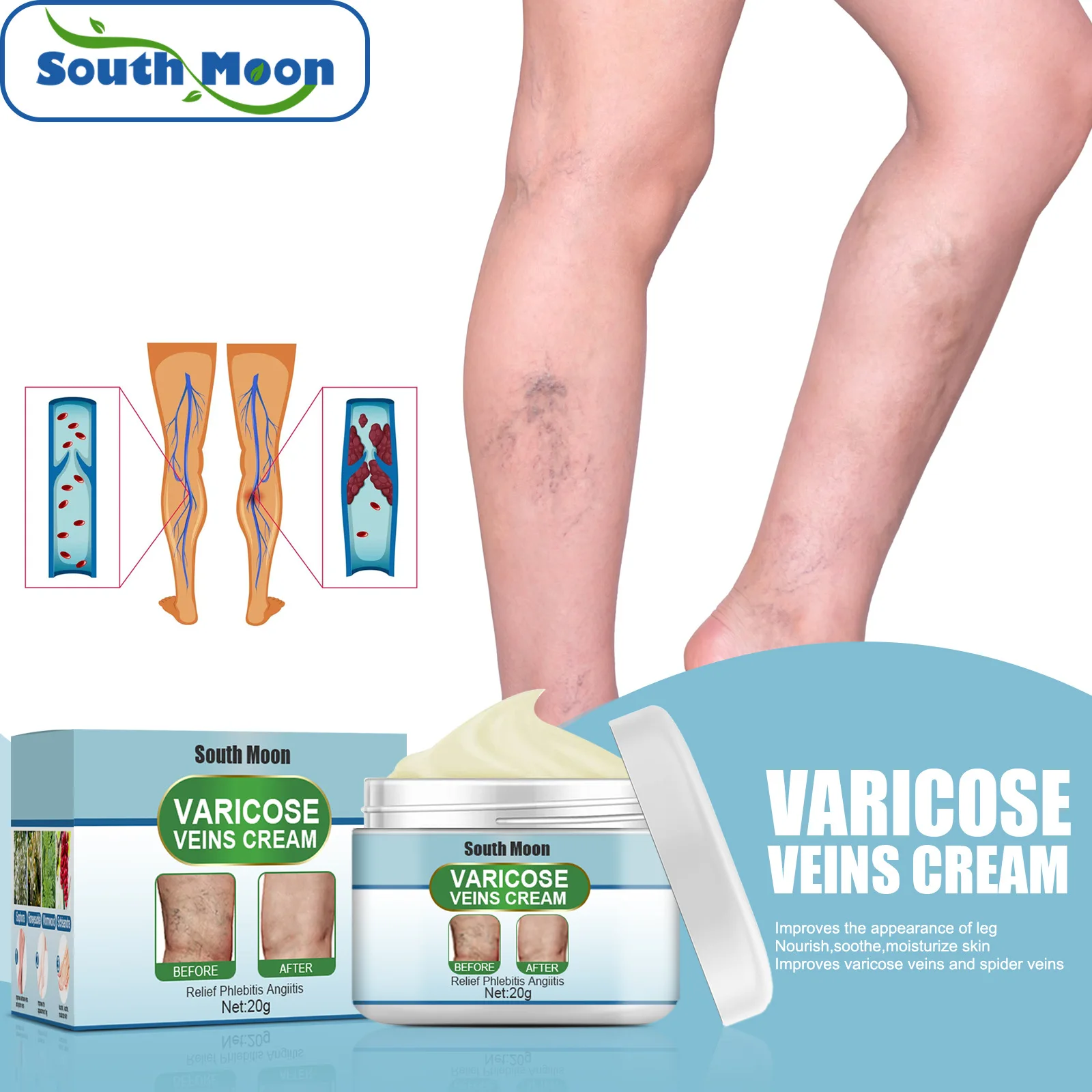 

South Moon Varicose Veins Cream Promoting Blood Circulati Pain Relief Ointment Promoting Blood Circulations Pain Relief Ointment
