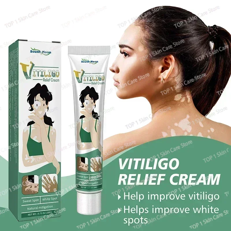 NewVitiligo Remove Cream Ringerworm Удаление белых пятен Уход за кожей Витилиго Устранение