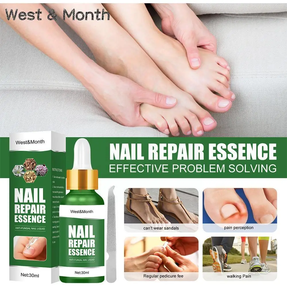 

Nail Fungal Repair Essence Serum Anti Fungal Nail Foot Nourishing Care Treatment Infection Anti Onychomycosis Toes Remove G Z4q7