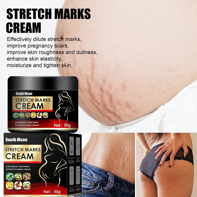 Maternity Stretch Marks Removal Cream Stretch Mark Buttock Breast Obesity Scars Removal Cream Pregnancy Whitening Skin Repair