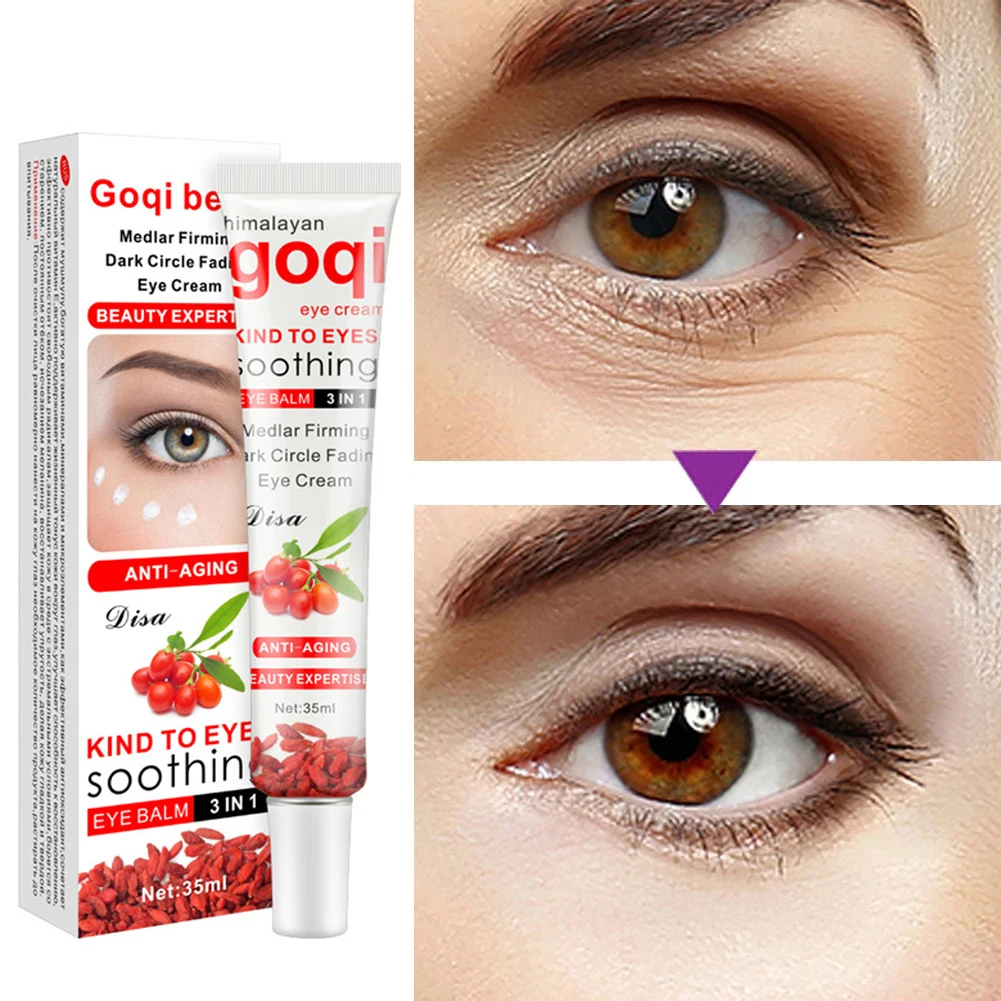 

Remove Dark Circles Eye Cream Remove Eye Bags Fade Crow's Feet Moisturizing Eye Cream Anti-Wrinkle Eye Cream Beauty Health