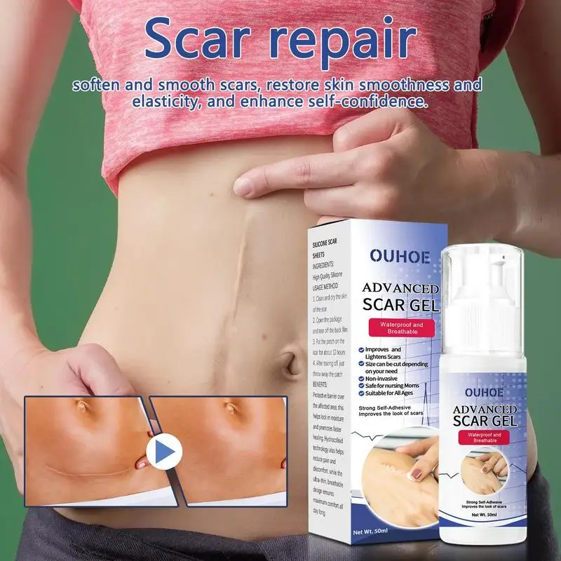 

Scar Removing Gel Repairing Pock Mark Burn Surgical Scar 1.69oz Not Greasy Scar Removal Cream Oil Control Acne Scar Gel For Body