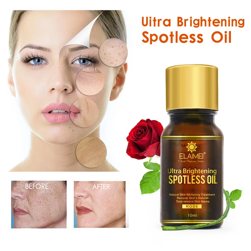 

10ml rose essential oil essence brightens moisturizes reduces scars spots brightens whitens skin care Free Shipping