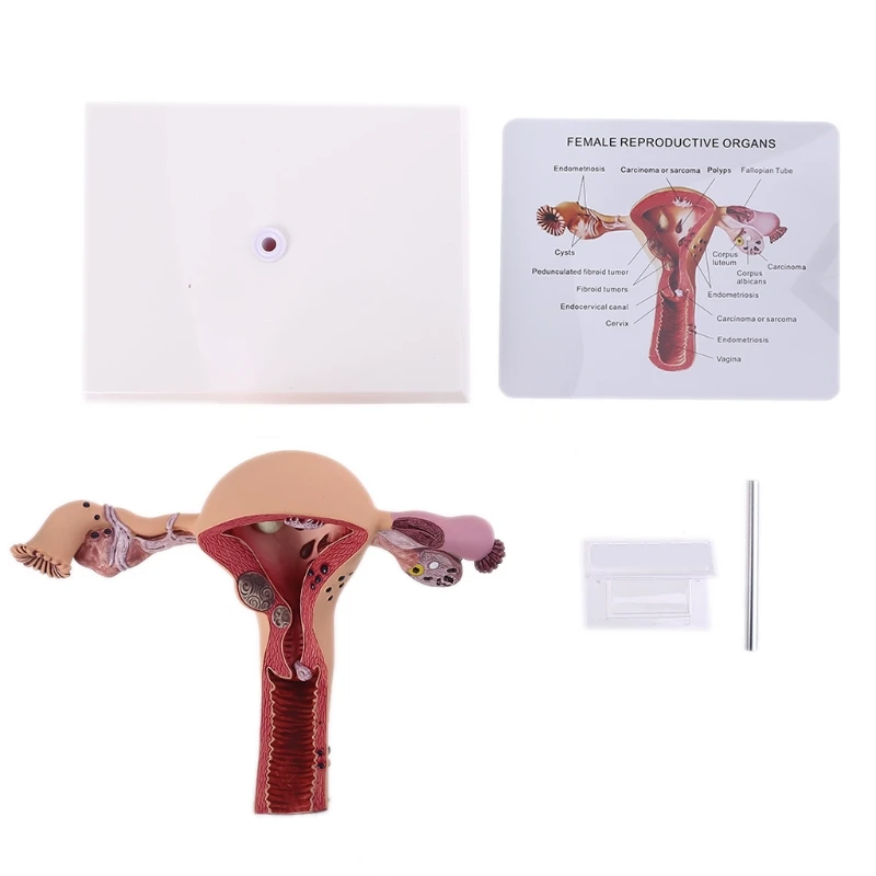 

Human Female Uterus Ovary Dissection Pathology Model Biology Teaching