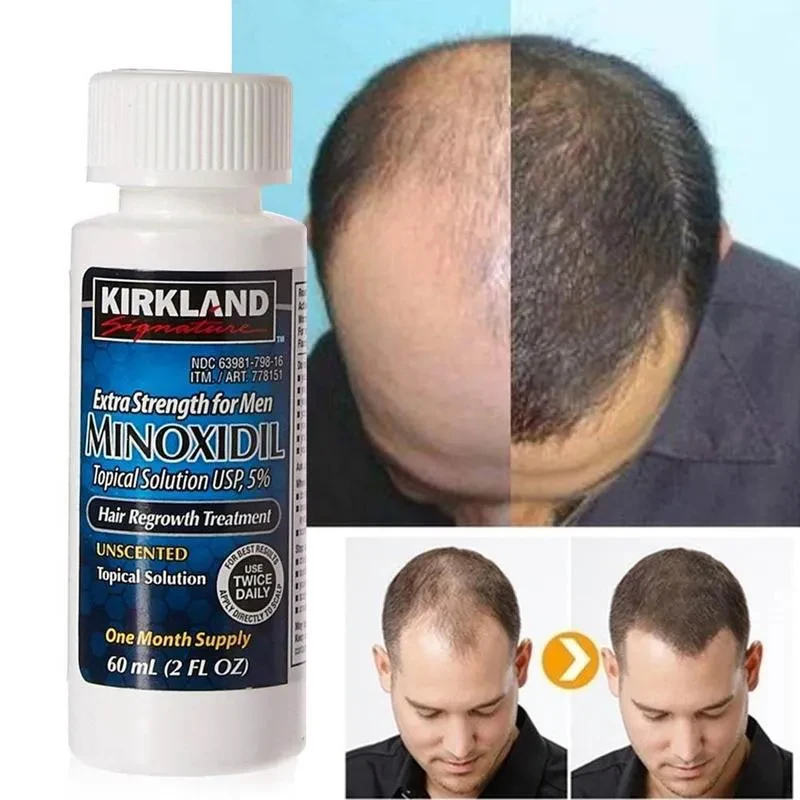 Миноксидил от выпадения волос. Миноксидил Kirkland 5 60 мл. Миноксидил Extra strength for men 60 мл. Миноксидил 5 для волос для мужчин. Minoxidil Kirkland 5% hair.