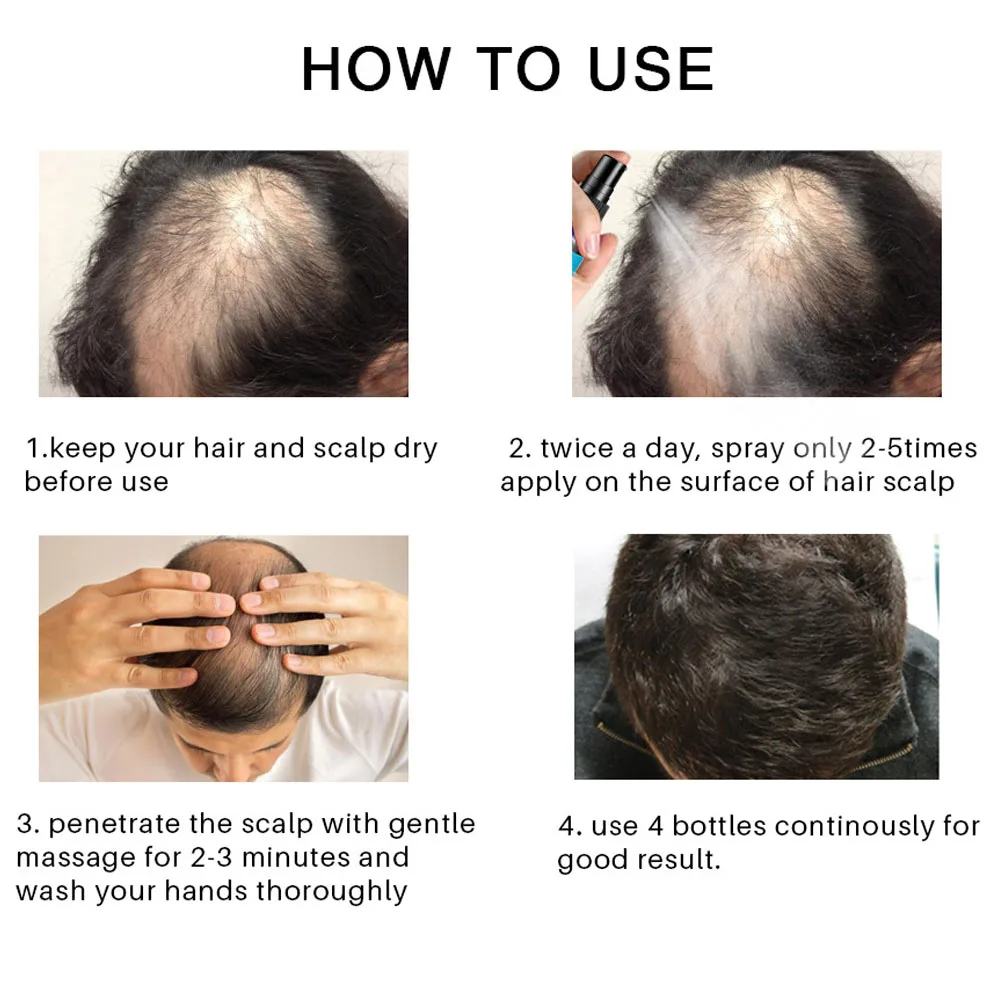 Имбирные продукты для роста волос против выпадения имбирное масло