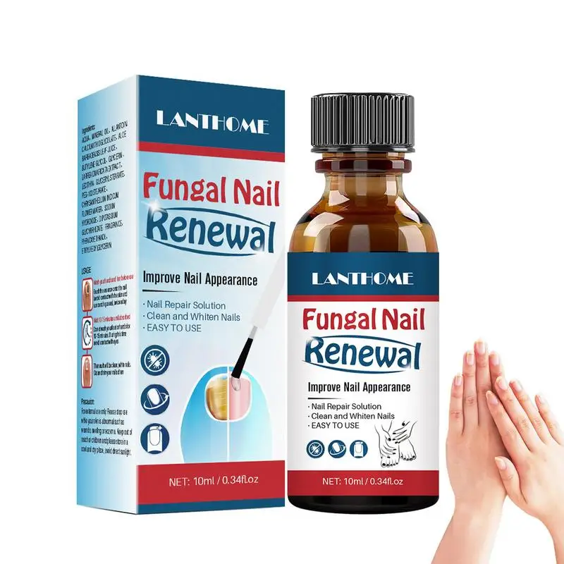 

10 мл эссенция для обработки ногтей Уход за ногами жидкость для удаления паронихии онихомикоза удаление поврежденных ногтей восстанавливающая эссенция