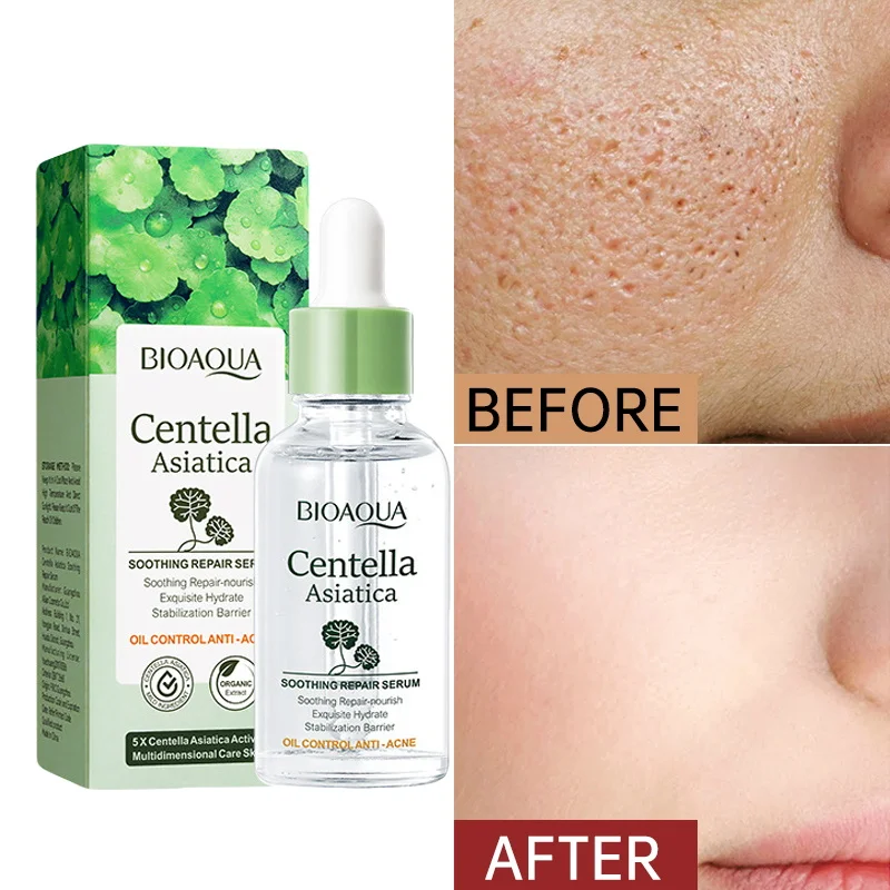 

Pore Shrinking Serum Centella Asiatica Essence Smooth Pores Anti Aging Bghten Whitening Moisturizing Korean skin care products