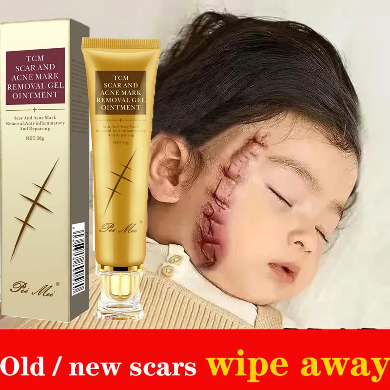 

3PC Acne Scar Removal Cream Skin Care Stretch Marks Treatment Pimples Spots Repair Gel Whitening Moisturizer Smooth Beauty Cream