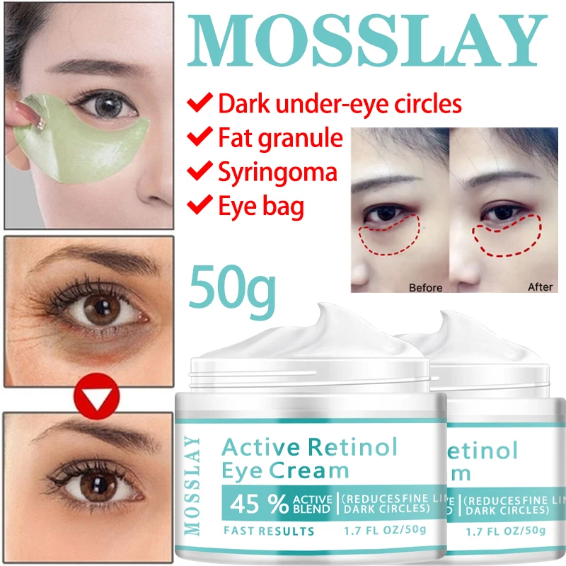

Отбеливающий крем для кожи вокруг глаз с витамином C-удаление темных кругов, уменьшение мешков под глазами, освежающая и увлажняющая эссенция для ухода за кожей вокруг глаз