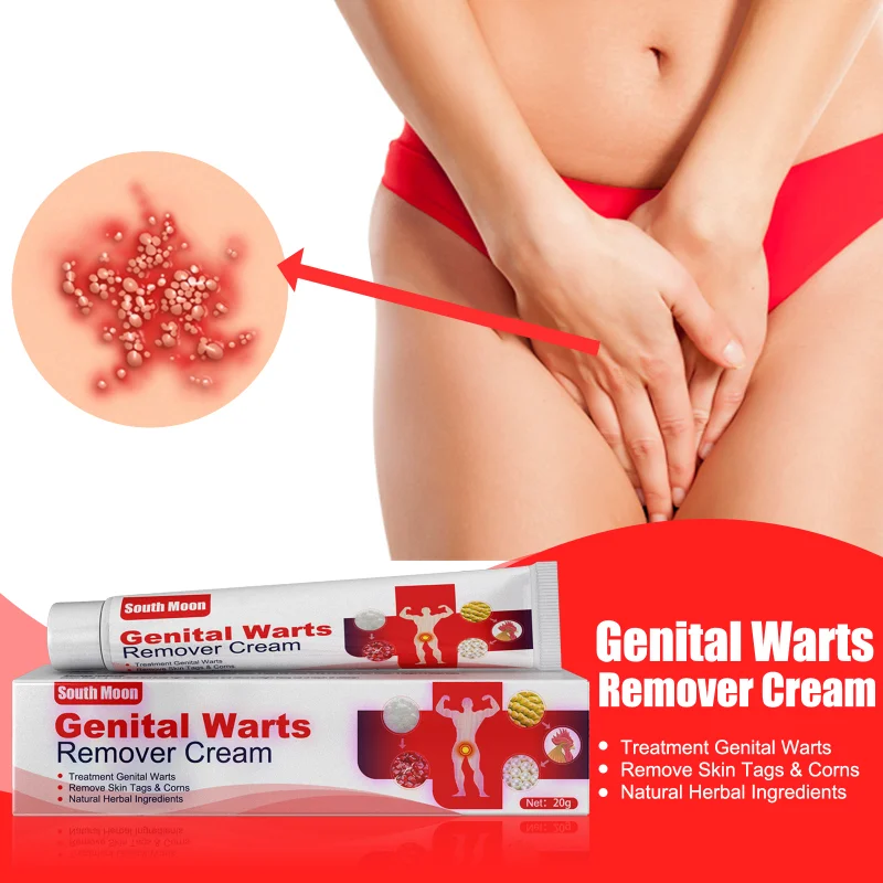 

Wart eliminator treatment Cream Skin Tag Remover foot Neck Body Mole Genital Warts Removal Chinese Herbal Medicine Ointment