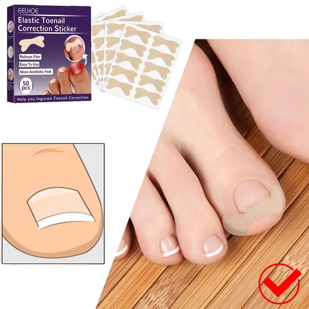 

Уход за ногами инструмент для педикюра и раздражения ногтей Корректор вросший ноготь водостойкие наклейки для коррекции ногтей Корректор ...