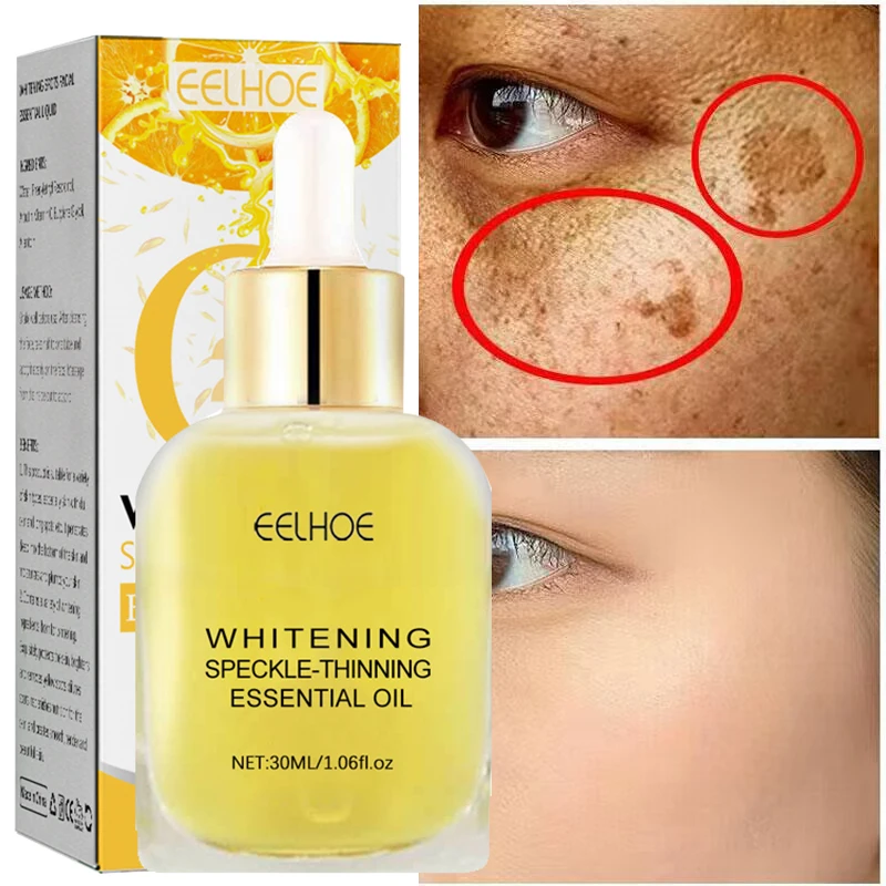 Effective Whitening Freckle Essence Products Vitamin C Remove Dark Spots Face Serum Fade Pigmentation Melasma Brighten Skin Care