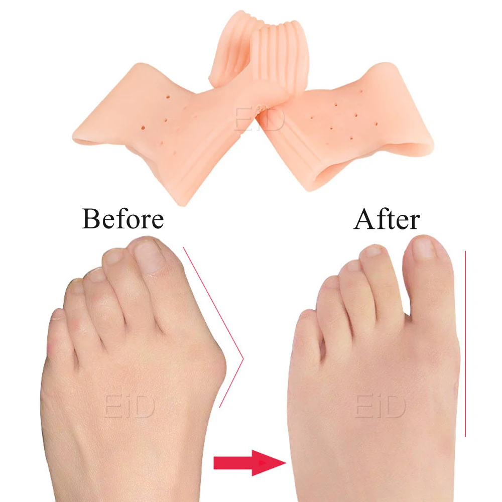 EiD Silicone Gel Toes Separator fot Hallux Valgus Orthotic Insoles Toe Correction Cushion Forefoot Pad Inserts Foot care Unisex