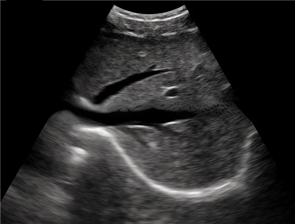 SUN-P1 ультразвуковой аппарат дисплей USB выпуклый зонд смартфон компьютер цена