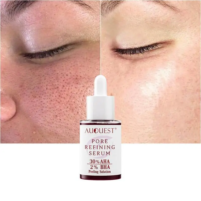 

Acne Face Serum Hydration Moisturizing Pore Shrinking Essence Facial Acne Marks Pockmark Repair Essence Skin Care Products