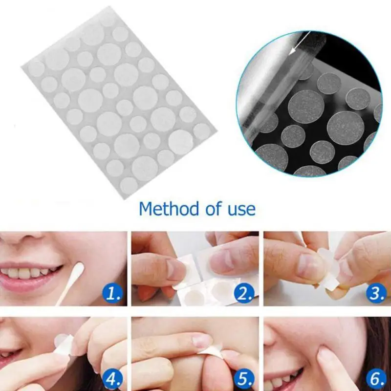 

Pimple Remover Patch Stickers Acne Pimple Patch Stickers Invisible Acne Acne Blackhead Remover Needle Tools
