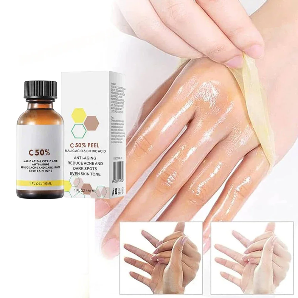 With Malic Acid And Citric For Face Facial Peel 40% Peeling Serum Chemical